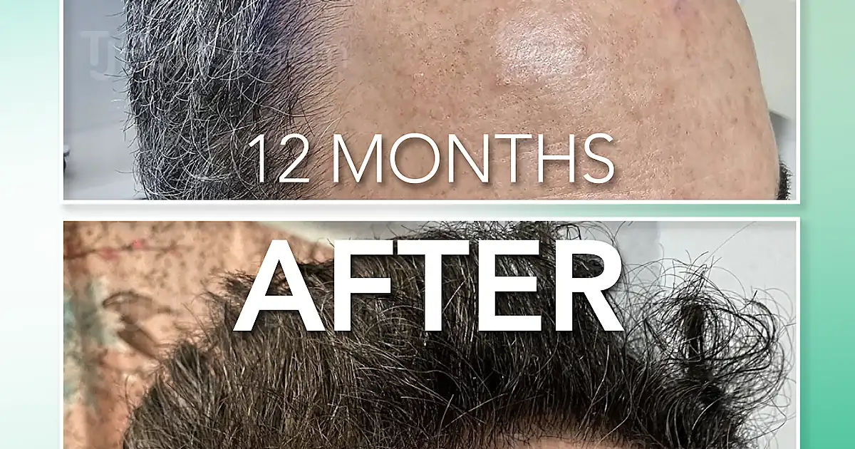TJ Hair Clinic