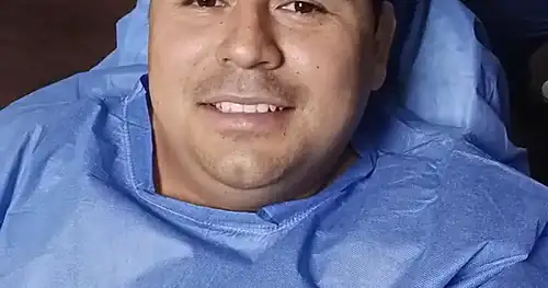 Transplante de cabello hair.c, transplante capilar en Monterrey, Nuevo León