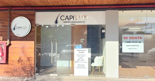 Capilux clínica de injerto capilar, transplante capilar en Mazatlán, Sinaloa