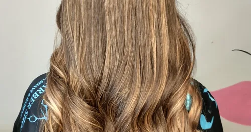Clínica de Belleza Ángeles, transplante capilar en Guaymas, Sonora