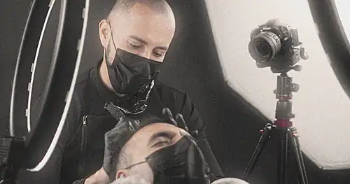 Bollywood Scalp: Micropigmentación Capilar en México, transplante capilar en Álvaro Obregón, Ciudad de México