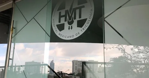 Hospital Mexicano de Tricología/ Injerto de Pelo/ Injerto Barba/Injerto Ceja, transplante capilar en Guadalajara, Jalisco