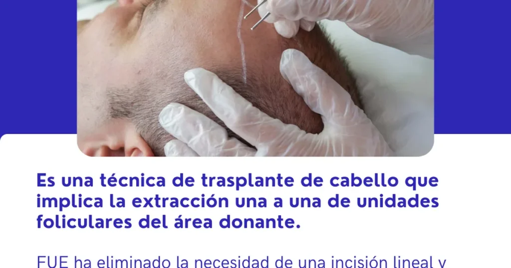 Trasplante de Cabello en Naucalpan – Dr. Luis Gabriel Esquivel
