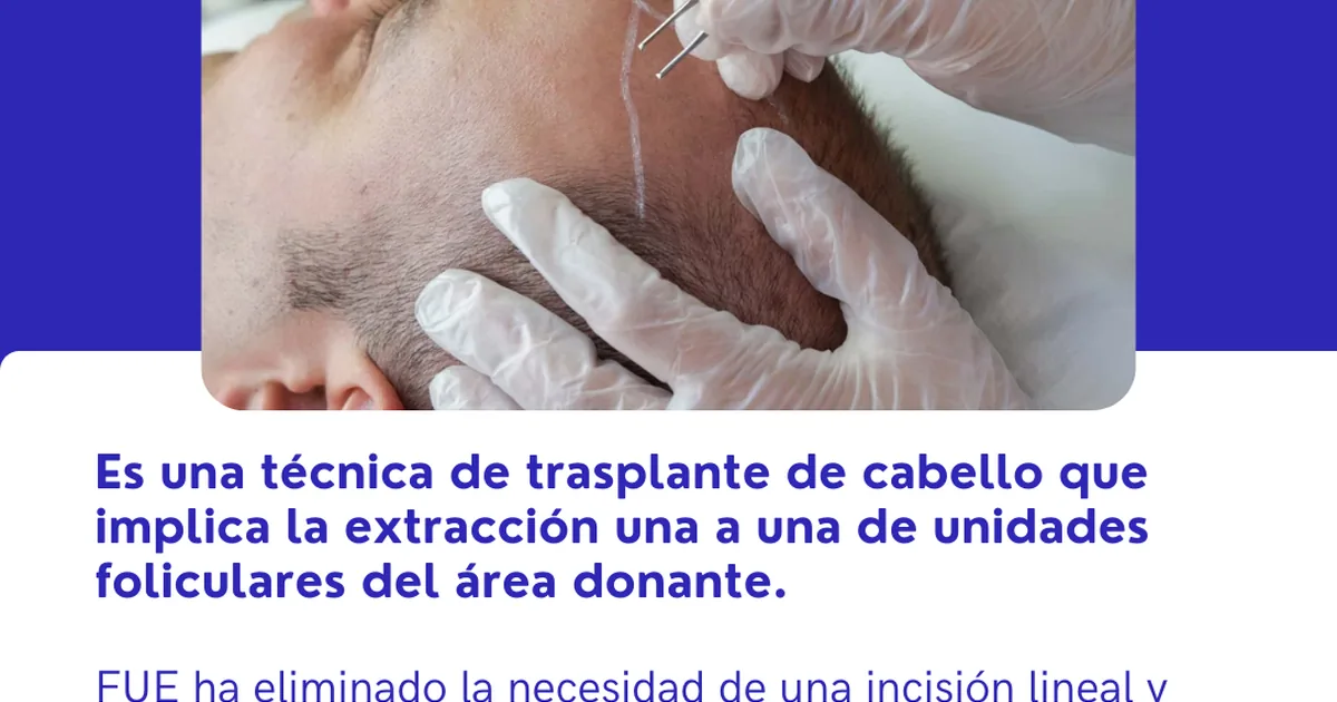Trasplante de Cabello en Naucalpan – Dr. Luis Gabriel Esquivel
