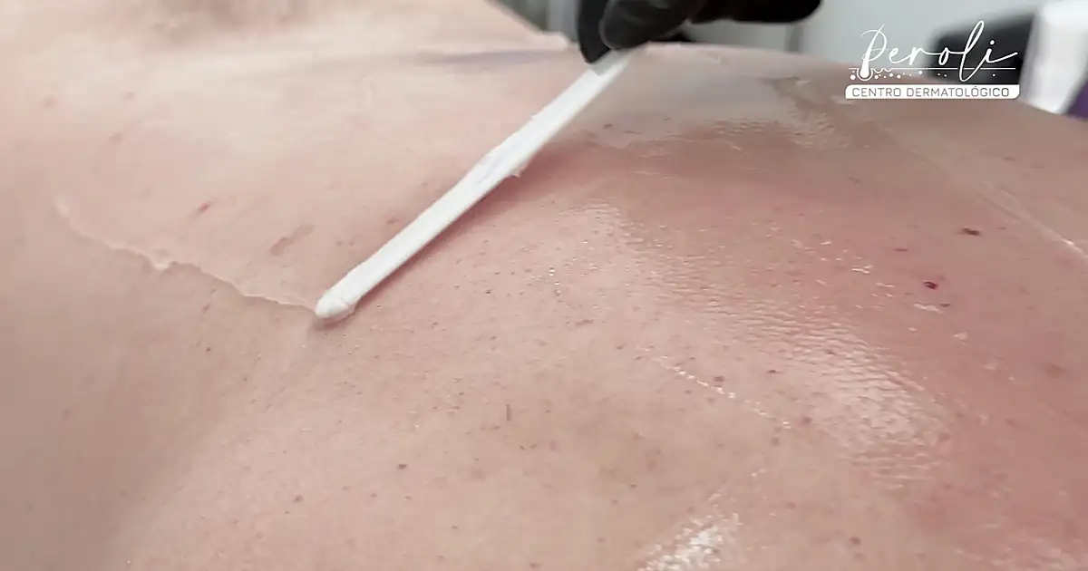 Centro Dermatológico Peroli