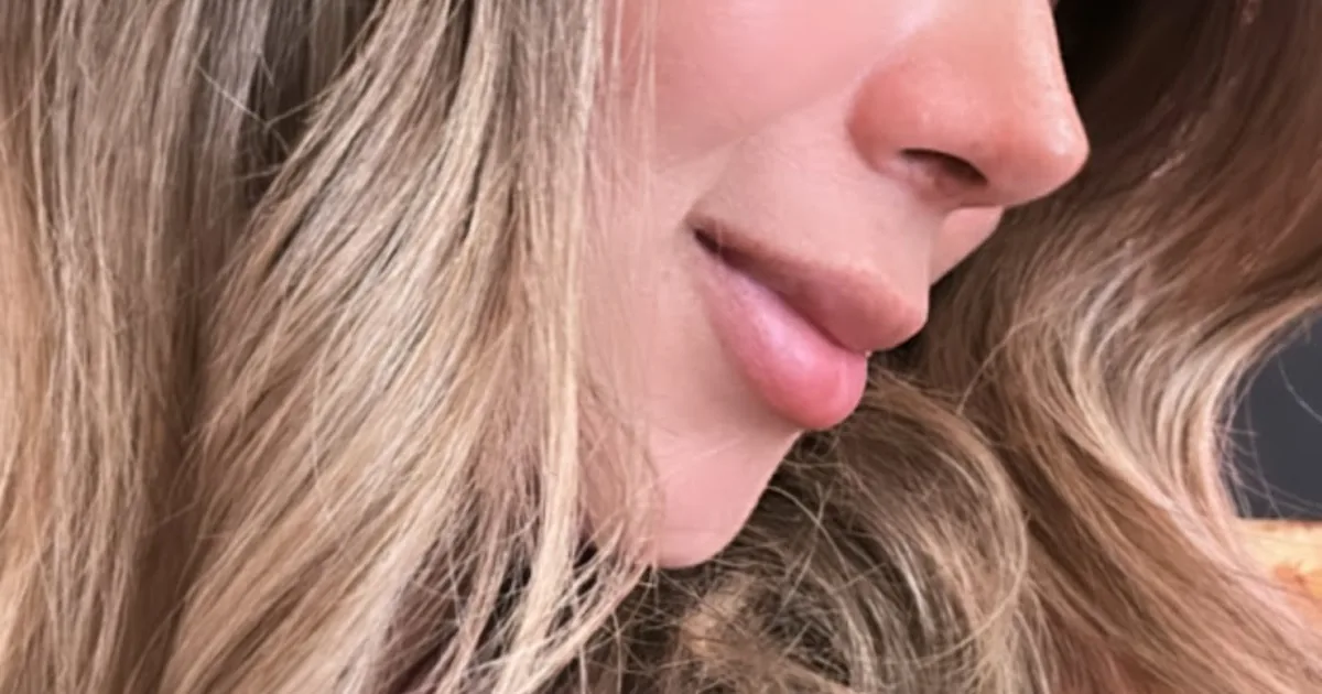 NASUS Rinoplastía y Cirugía Plástica Facial