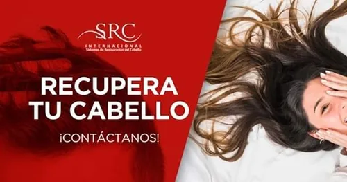 SRC Internacional Morelia, transplante capilar en Morelia, Michoacán