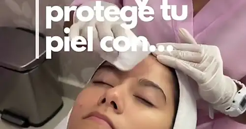 Dermatología Integral Poza Rica, transplante capilar en Poza Rica, Veracruz