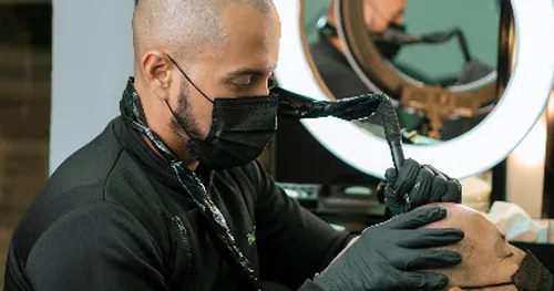 Bollywood Scalp: Micropigmentación Capilar en Mérida, transplante capilar en Mérida, Yucatán